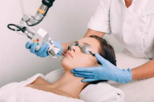 Laser-facials-by-Healthy-Glow-Beauty-in-Rowley-MA