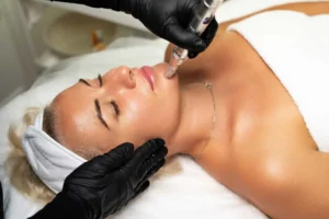 Microneedling-by-Healthy-Glow-Beauty-in-Rowley-MA