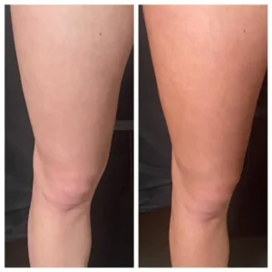 bf-tanning by Healthy Glow Beauty in Rowley MA