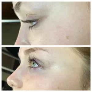 eyes-bf by Healthy Glow Beauty in Rowley MA