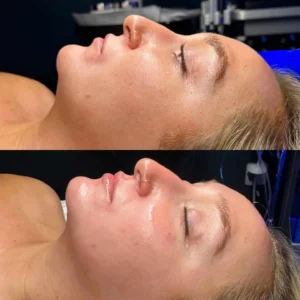 skin-before-and-after-three