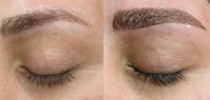 braws-eyes-treatment by Healthy Glow Beauty in Rowley MA
